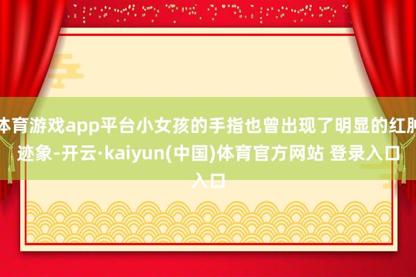 体育游戏app平台小女孩的手指也曾出现了明显的红肿迹象-开云·kaiyun(中国)体育官方网站 登录入口